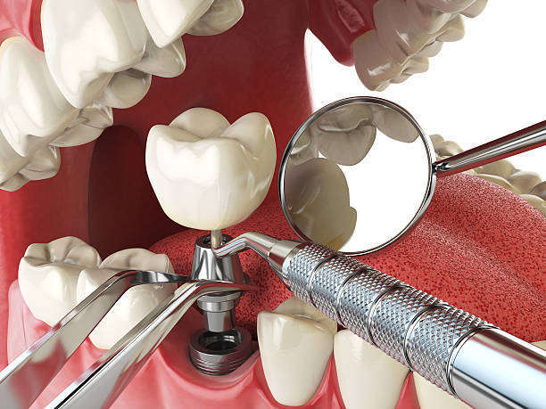 Best Emergency Dental Services for Seniors in Emma, NC
